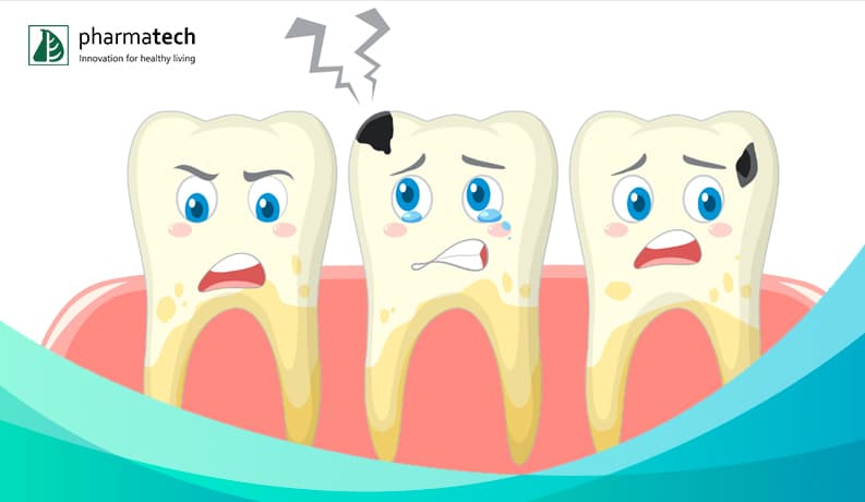 Fluor là công cụ đắc lực phòng ngừa sâu răng vượt trội
