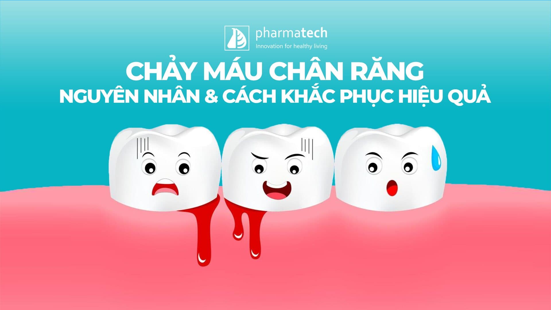 CHẢY MÁU CHÂN RĂNG –  NGUYÊN NHÂN &amp; CÁCH KHẮC PHỤC HIỆU QUẢ